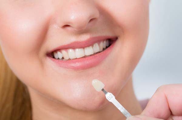 How Teeth Are Prepared For Dental Veneers