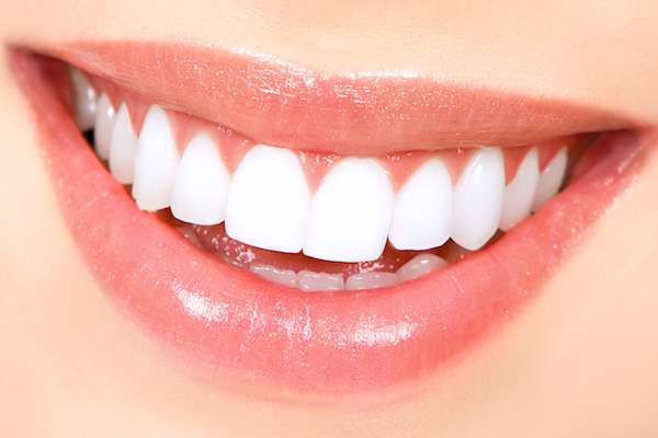 How Long Does Teeth Whitening Take from Palm Beach Institute of Dentistry in West Palm Beach, FL