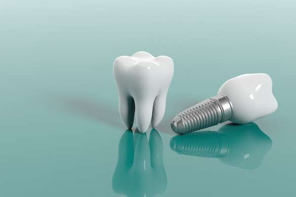 Multiple Teeth Replacement Options: One Implant for Two Teeth from Palm Beach Institute of Dentistry in West Palm Beach, FL